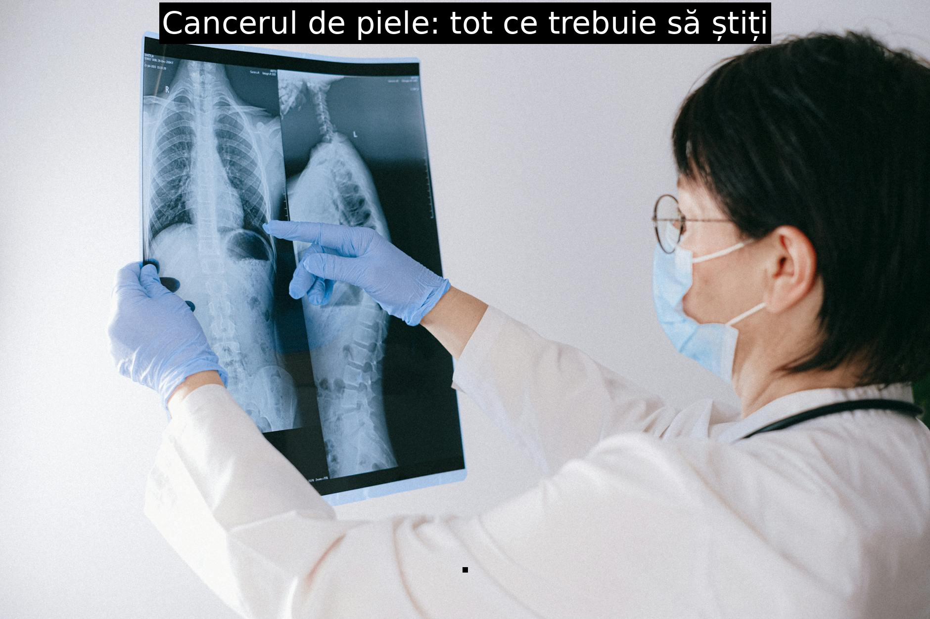 Cancerul de piele: tot ce trebuie să știți