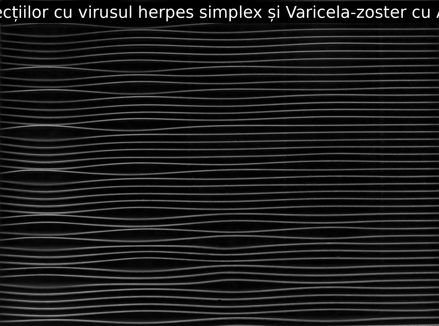 Tratamentul infecțiilor cu virusul herpes simplex și Varicela-zoster cu Arbivir Prospect.